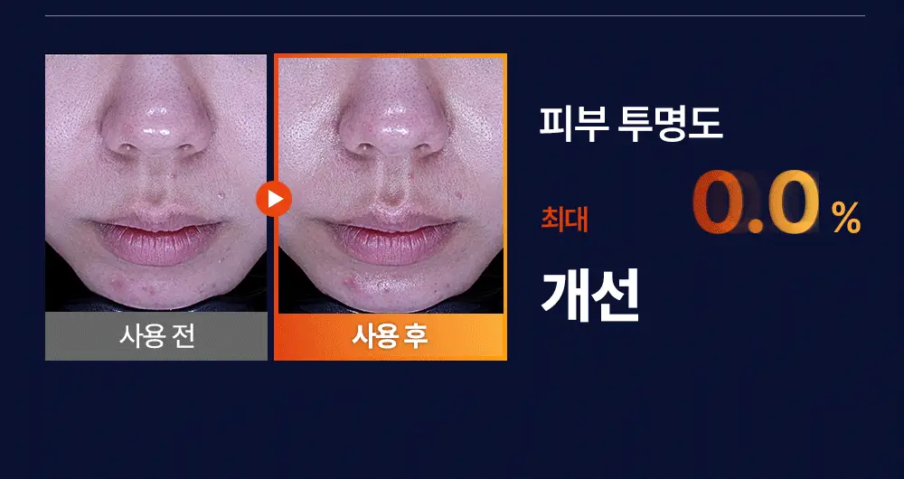 [순수비타민C/잡티앰플] 마미케어 오쏘타민 비타민C 앰플 15ml 상세페이지 11